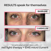 2-in-1 Red Light + EMS Under-Eye Therapy
